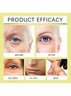 [BUY 1 GET 1 FREE] Retinal Tightening Booster.