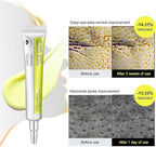 [BUY 1 GET 1 FREE] Retinal Tightening Booster.