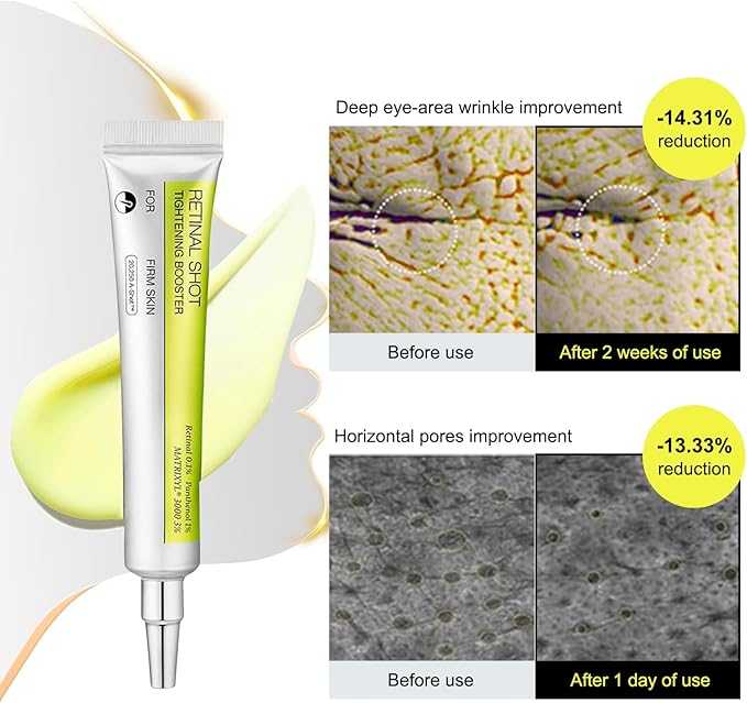 [BUY 1 GET 1 FREE] Retinal Tightening Booster.